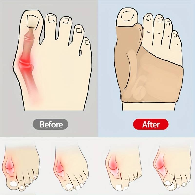 1 Paire De Couvre-pieds Doux : Séparateur D'orteils, Correcteur D'hallux Valgus Et Couvre-paume Pour Un Confort Maximal !